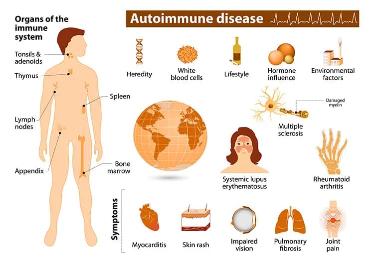 Chronic and Autoimmune Conditions